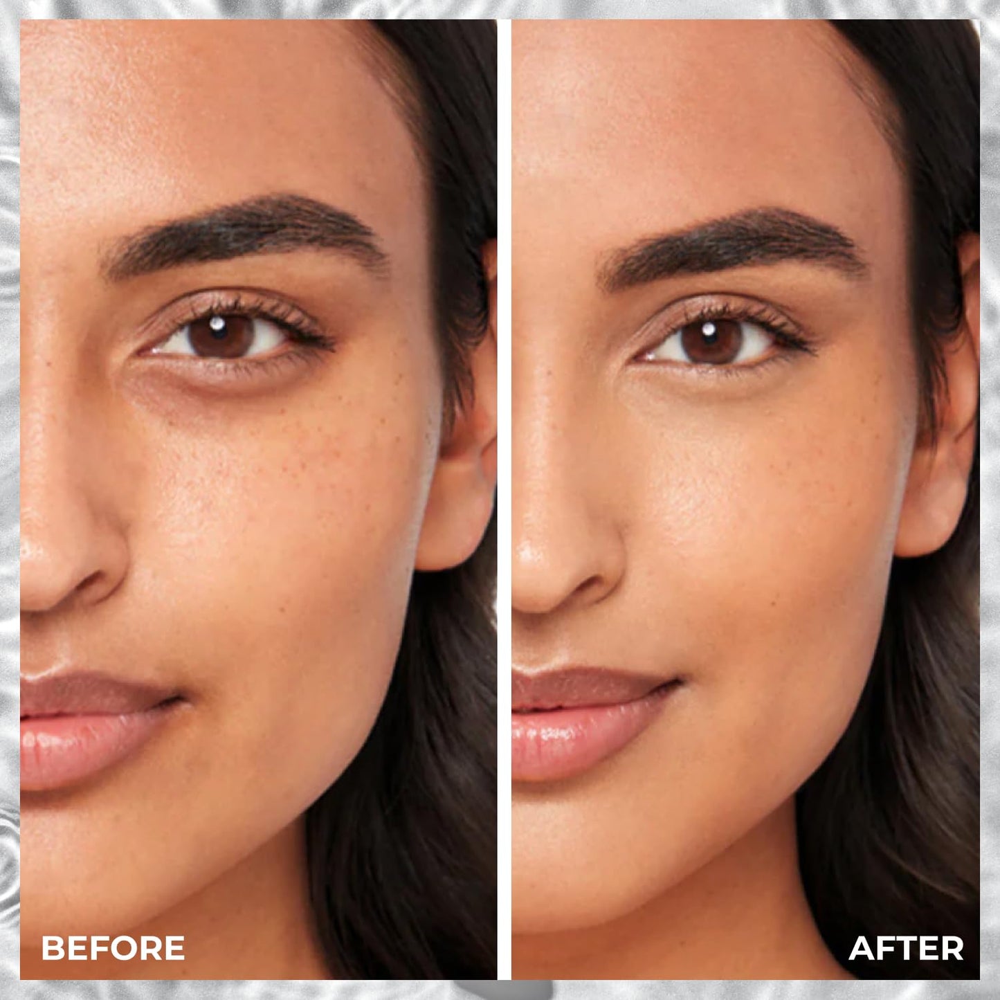 Smart Skin Concealer 403 Light Medium